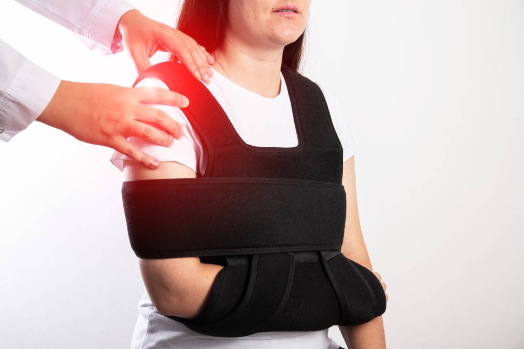 Fractura diafisaria de húmero